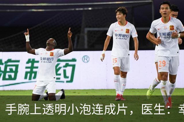 手腕上透明小泡连成片，医生：幸好没弄到眼睛里